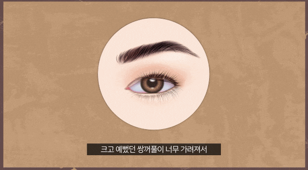 상안검하안검수술 부작용 걱정된다면 이 글을 필독해주세요 관련 이미지 8