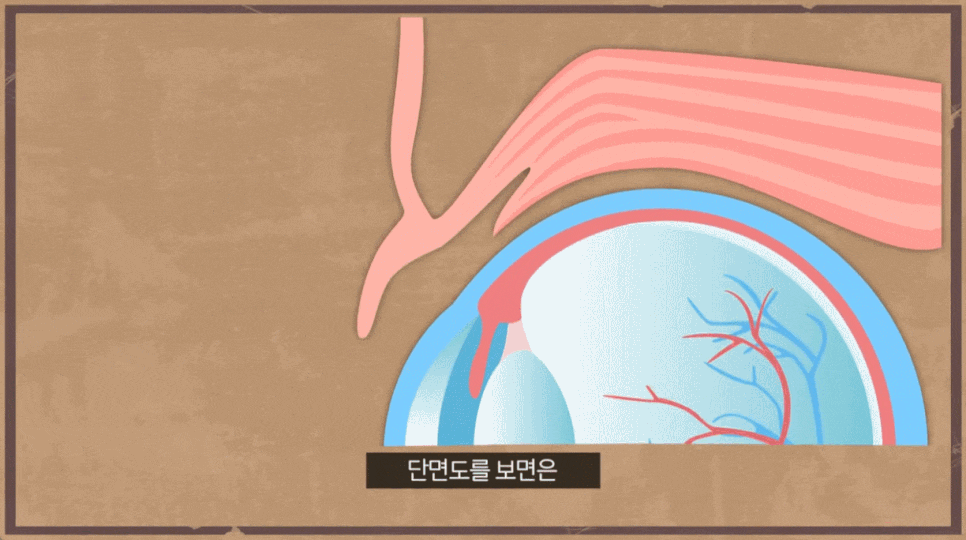 상안검 수술 성형외과 찾을 때 이것을 꼭 확인하세요. 관련 이미지 5