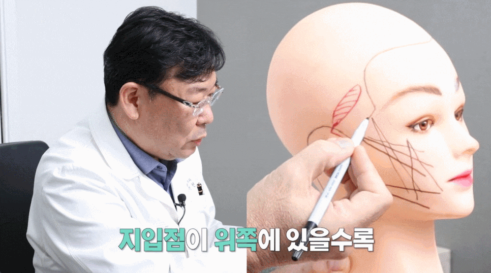 처진 얼굴 실리프팅 광대 커짐을 예방하려면? 관련 이미지 4