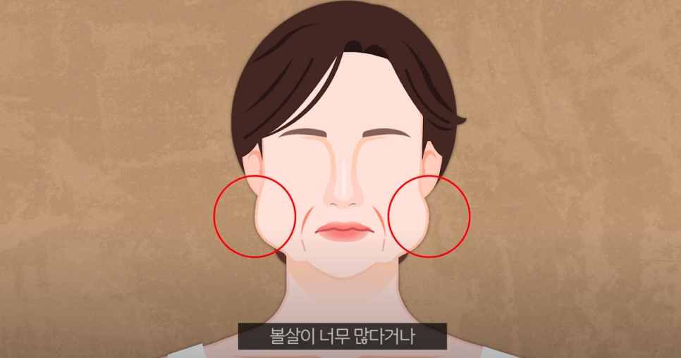 신논현성형외과 주름개선 후기 관련 이미지 3