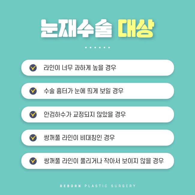 신사동눈재수술 성공하기 위해서는 관련 이미지 3
