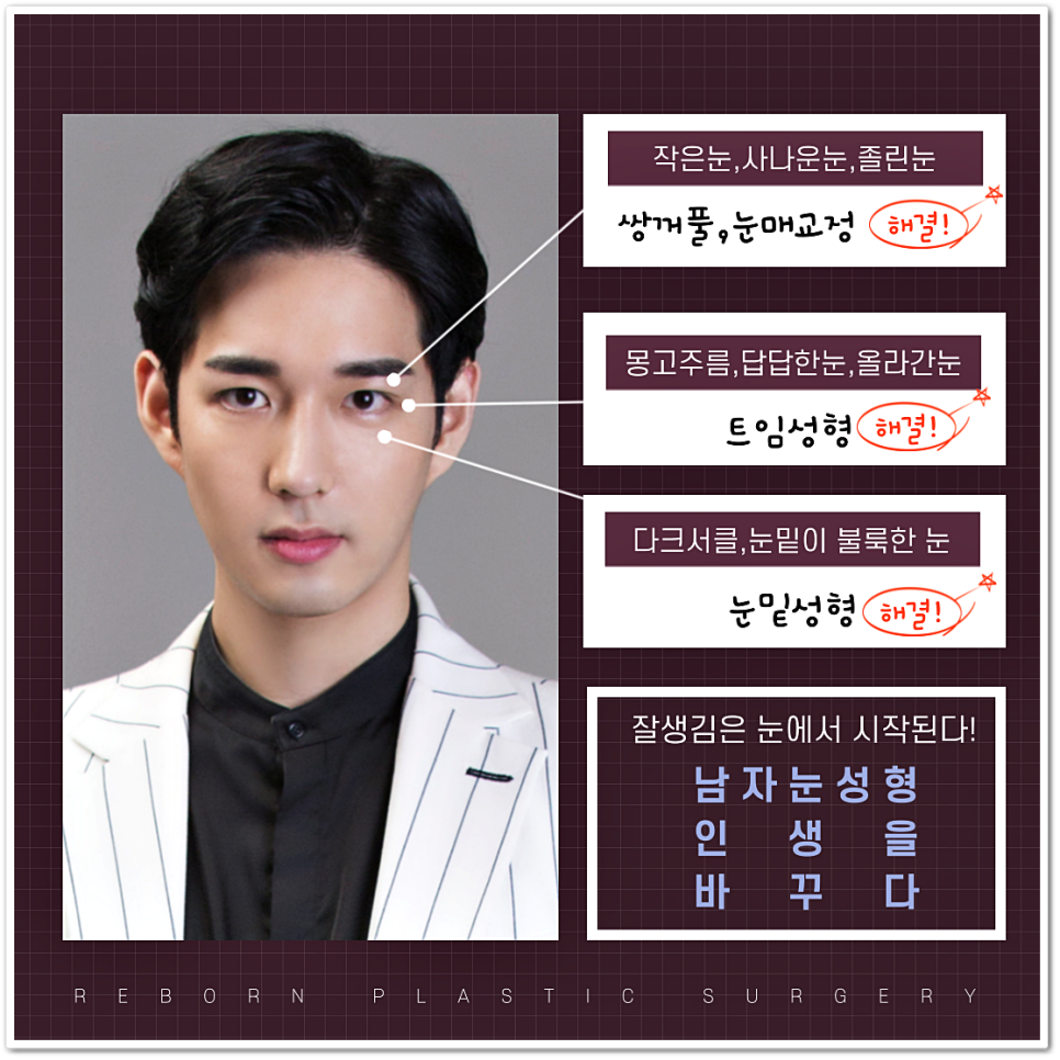 훈남프로젝트! 남자눈성형으로 나도 이제 훈남? 관련 이미지 2