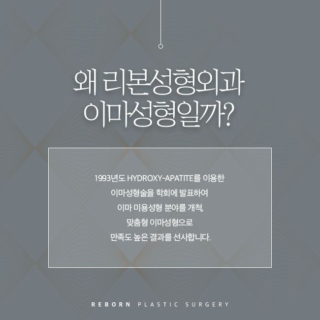 신사역이마보형물 누가봐도 관련 이미지 2