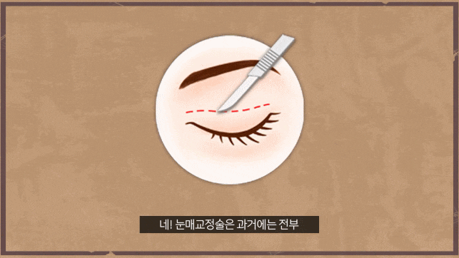 What happens if you only get double eyelid surgery when you have ptosis? Why do you need eyelid correction? image 1