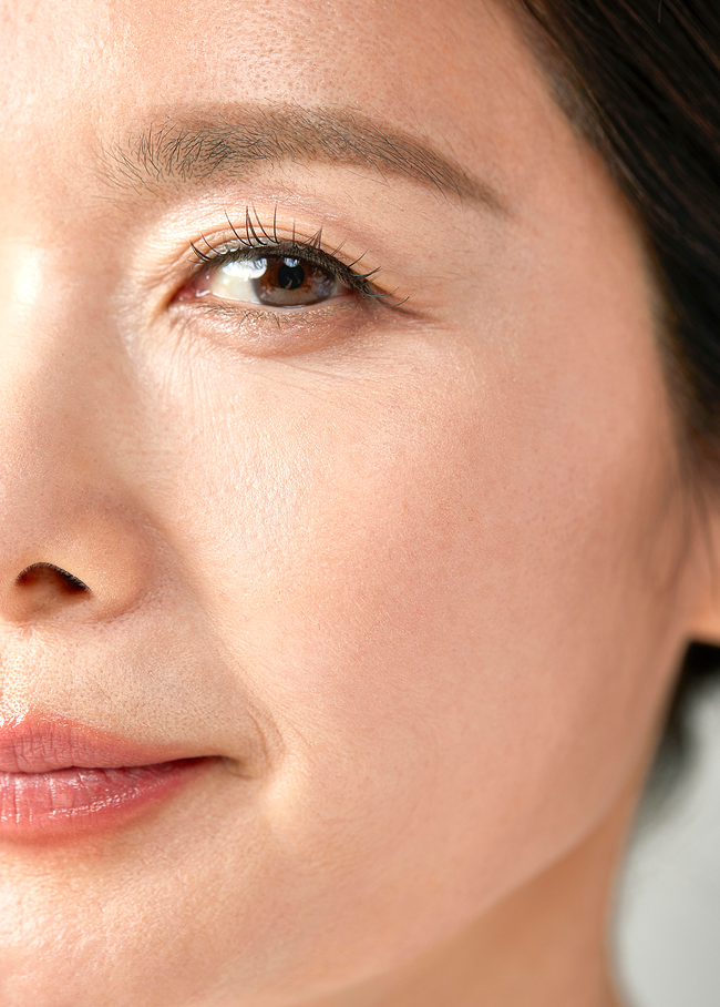 Is It Okay to Repeat Thread Lifting? Effects and Duration Based on Wrinkles and Facial Sagging image 1