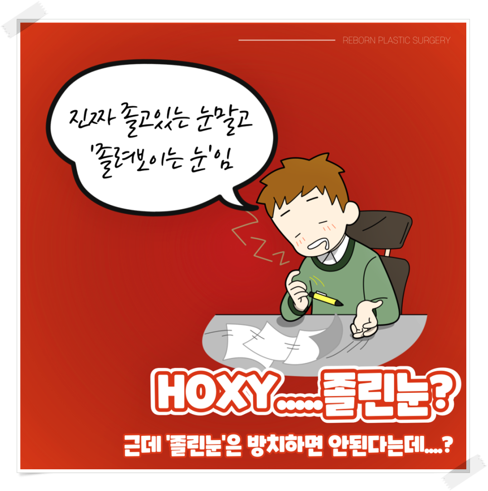 졸린눈교정 꼭 해야 하는 이유가 있나요? 관련 이미지 2