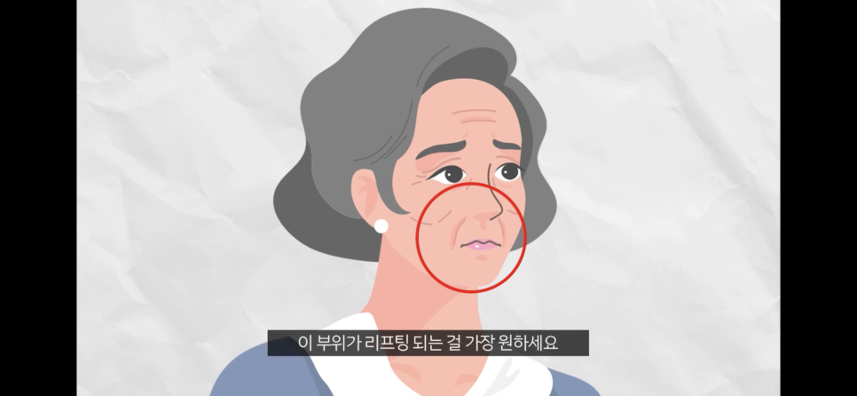 압구정리프팅 팔자주름거상에 실 필요?(feat.리본성형외과) 관련 이미지 4