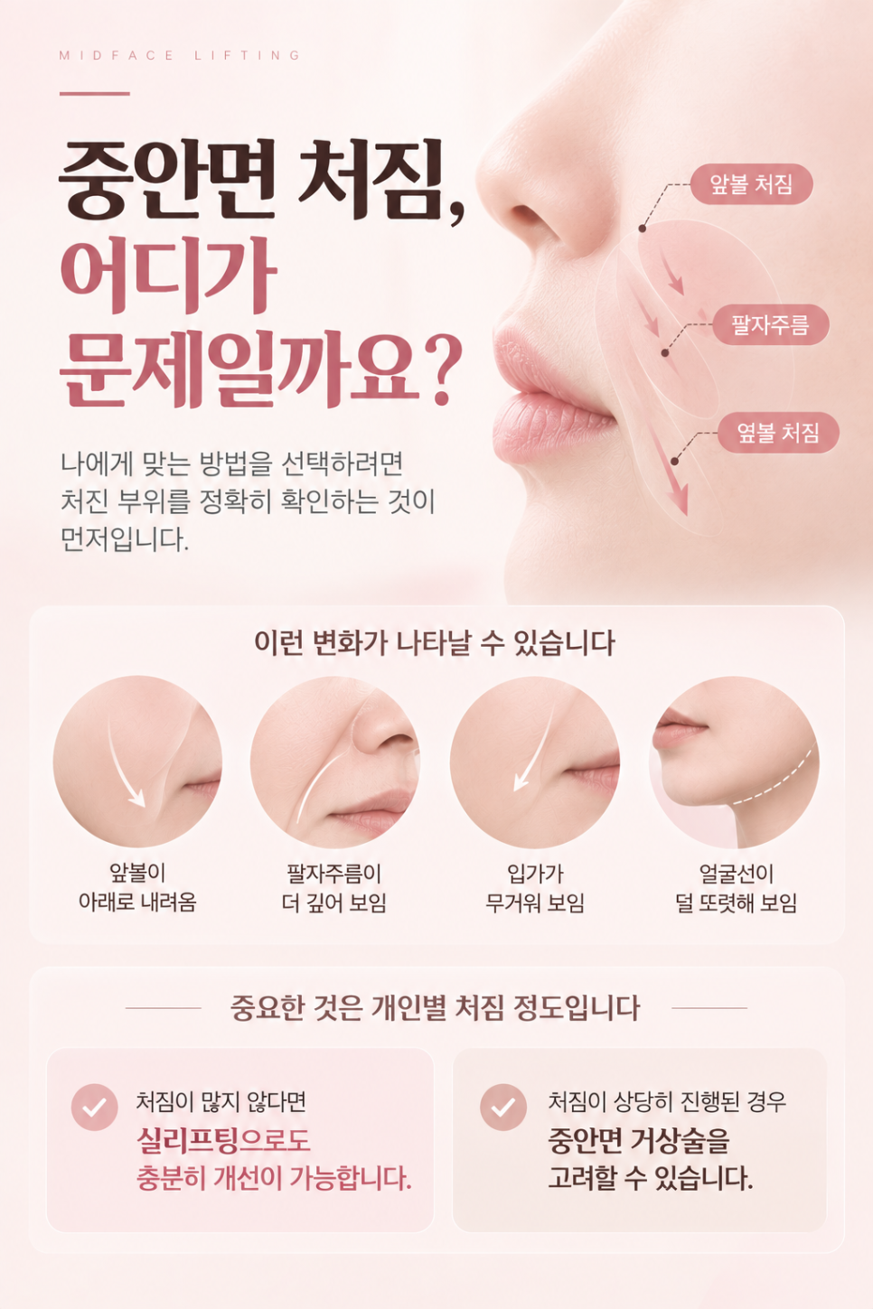 중안면 거상 수술이 아닌 실리프팅으로 충분히 효과 볼 수 있는 유형은 관련 이미지 4