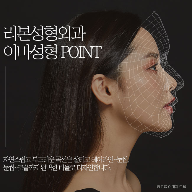 이마성형비용 궁금하다면 관련 이미지 4