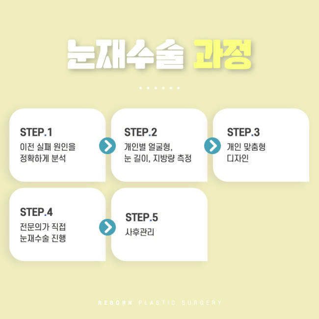 강남눈재수술 이번엔 성공하자 관련 이미지 2