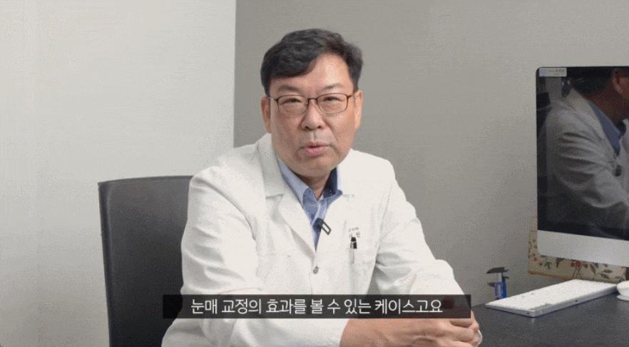 처진 눈 눈매교정 수술 받기 전 이 글을 읽어보세요. 관련 이미지 3