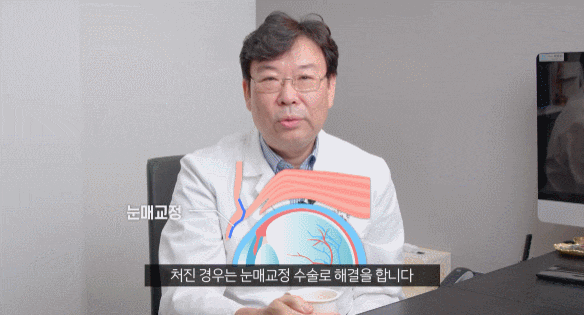 If You Have Uneven Eyelid Correction in Nonhyeon-dong, You Should Not Have Double Eyelid Surgery Alone. image 3