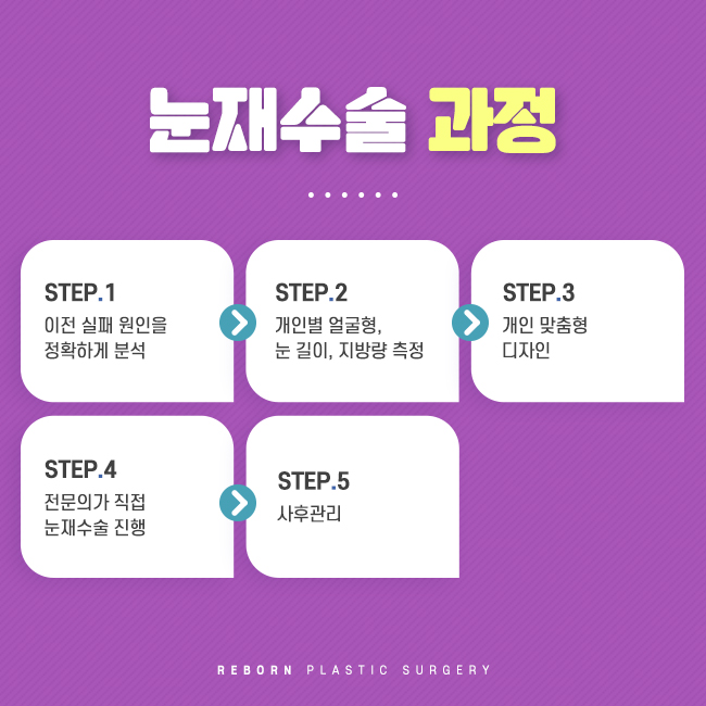 논현눈재수술 이제 실패는 안하도록 관련 이미지 2