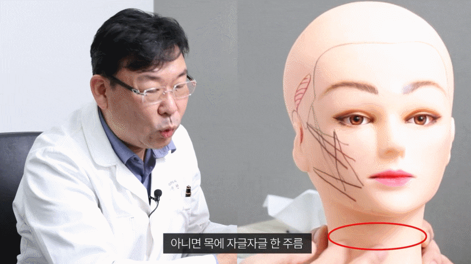 미니안면거상성형? 늘어진 눈가, 광대살 함께 개선하고 싶은 분들께 관련 이미지 6