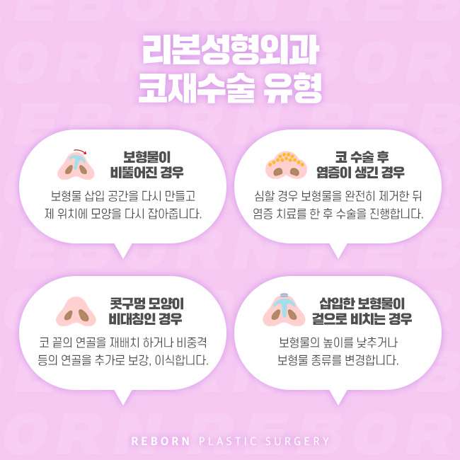 강남코재수술 원인을 찾는 것이 중요 관련 이미지 3