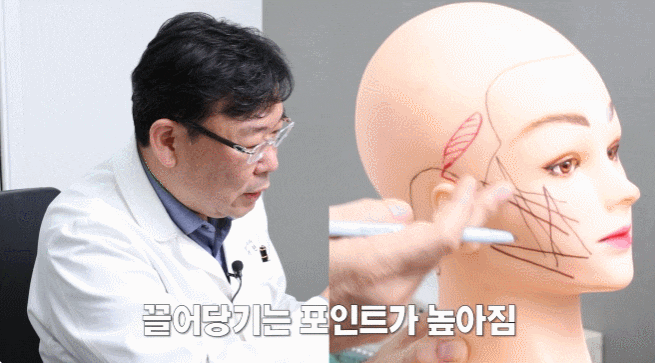 논현 실리프팅 잘하는 성형외과 관련 이미지 2