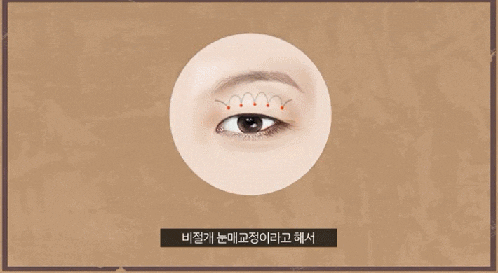 신논현역 눈매교정 잘하는 성형외과 찾기 전 필독해주세요. 관련 이미지 3