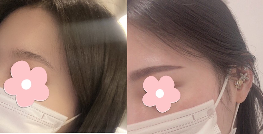 반영구눈썹 자연스럽게🙋‍♀️ with 신사동성형외과 관련 이미지 7