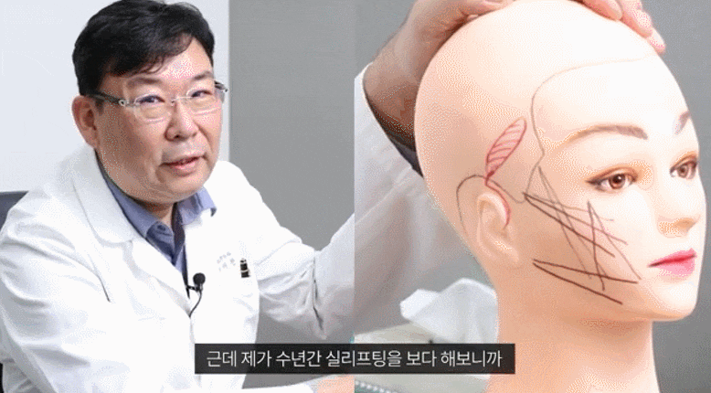 If you're concerned about how long results last before looking for a plastic surgery clinic for mini facelift surgery image 3