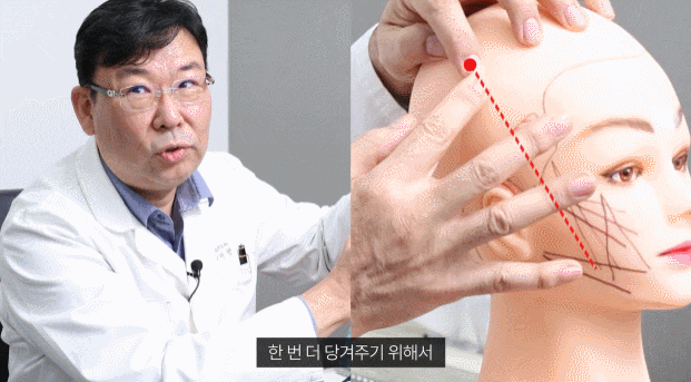신사동 실리프팅 관련 이미지 4