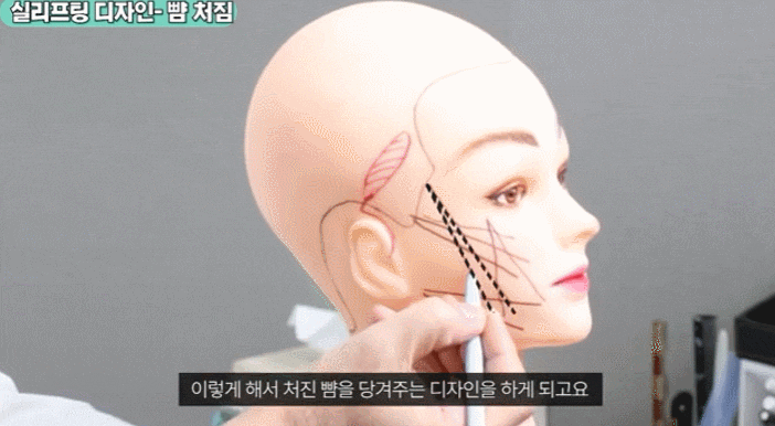 신사동 실리프팅, 여러분이 쉽게 놓치는 여러 부분들 관련 이미지 2