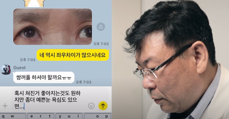 Apgujeong Middle-Aged Eye Surgery: Refined and Elegant image 1