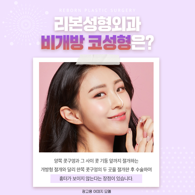 강남역코성형 비개방으로 시작되는, 관련 이미지 2