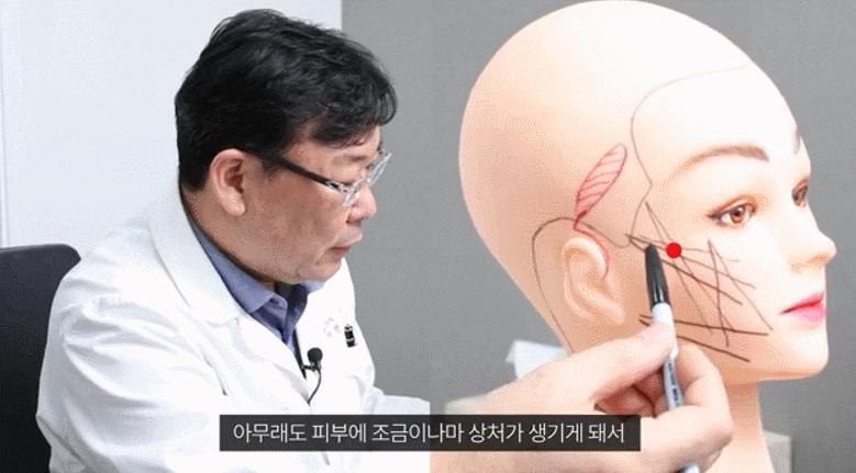 미니얼굴거상 실리프팅 성형외과에서는 관련 이미지 1
