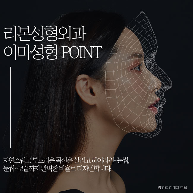 신사성형외과 봉긋한 이마를 위한 관련 이미지 4