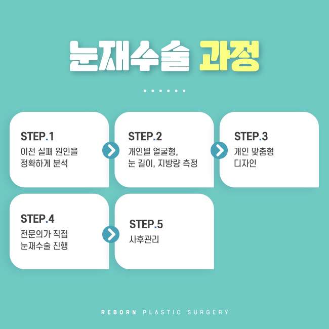 신사동눈재수술 성공하기 위해서는 관련 이미지 2