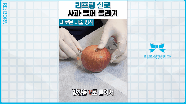 중안면거상 비용, 실리프팅 잘하는 곳으로 가야 하는 이유 관련 이미지 1