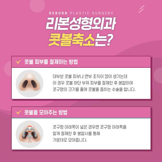신논현성형외과 콧볼축소도 신중해야 관련 이미지 3