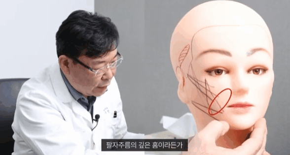 중안부리프팅 가격, 후기 궁금하신 분들에게 관련 이미지 1