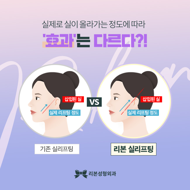 강남역실리프팅 예뻐지잖아 관련 이미지 3