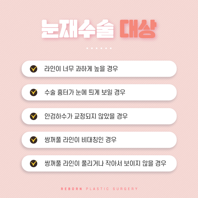 신사역성형외과 나의 눈을 다시 관련 이미지 3