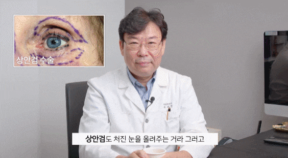 Midlife Eye Surgery in Your 40s and 50s: How Can You Regain Youth? image 5