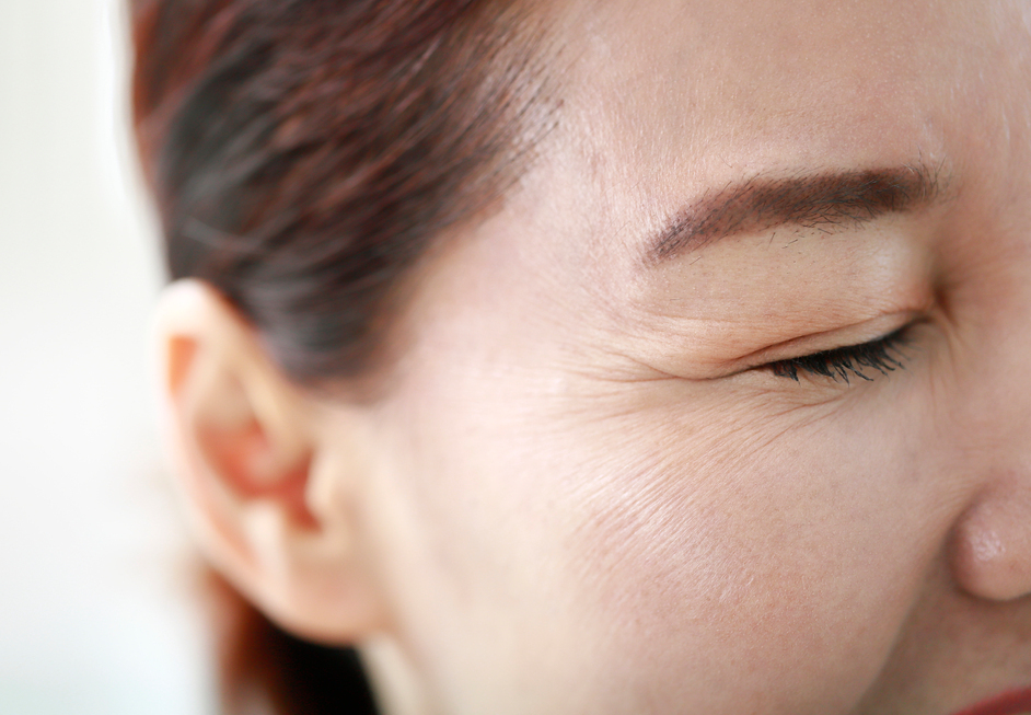 Blepharoplasty Review in Sinsa, for Those Looking for Before-and-After Photos... image 4