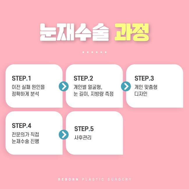 강남역눈재수술 성공을 위해 주의해야 할 것 관련 이미지 2