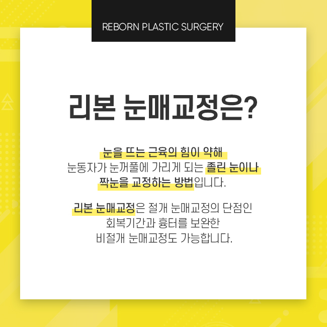 신사눈매교정 개인에 따라서 선택 중요 관련 이미지 2