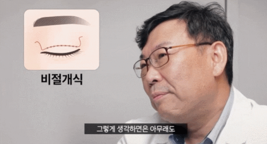 At Nonhyeon Station, a Plastic Surgery Clinic Explains the Differences Between Incisional and Non-Incisional Eye Correction. image 3
