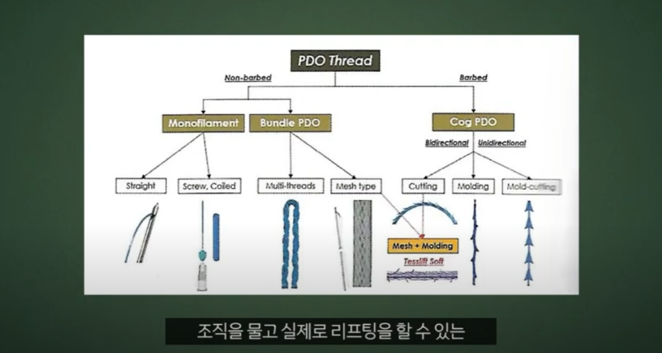 압구정 리프팅실종류 제작까지 직접 참여하는 관련 이미지 2