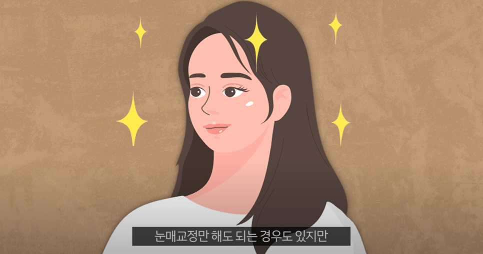 압구정 눈매교정가격 20대~70대 까지 관련 이미지 4