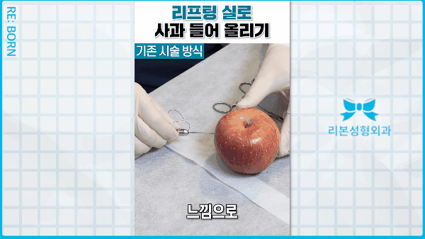 중안면거상 비용, 실리프팅 잘하는 곳으로 가야 하는 이유 관련 이미지 3
