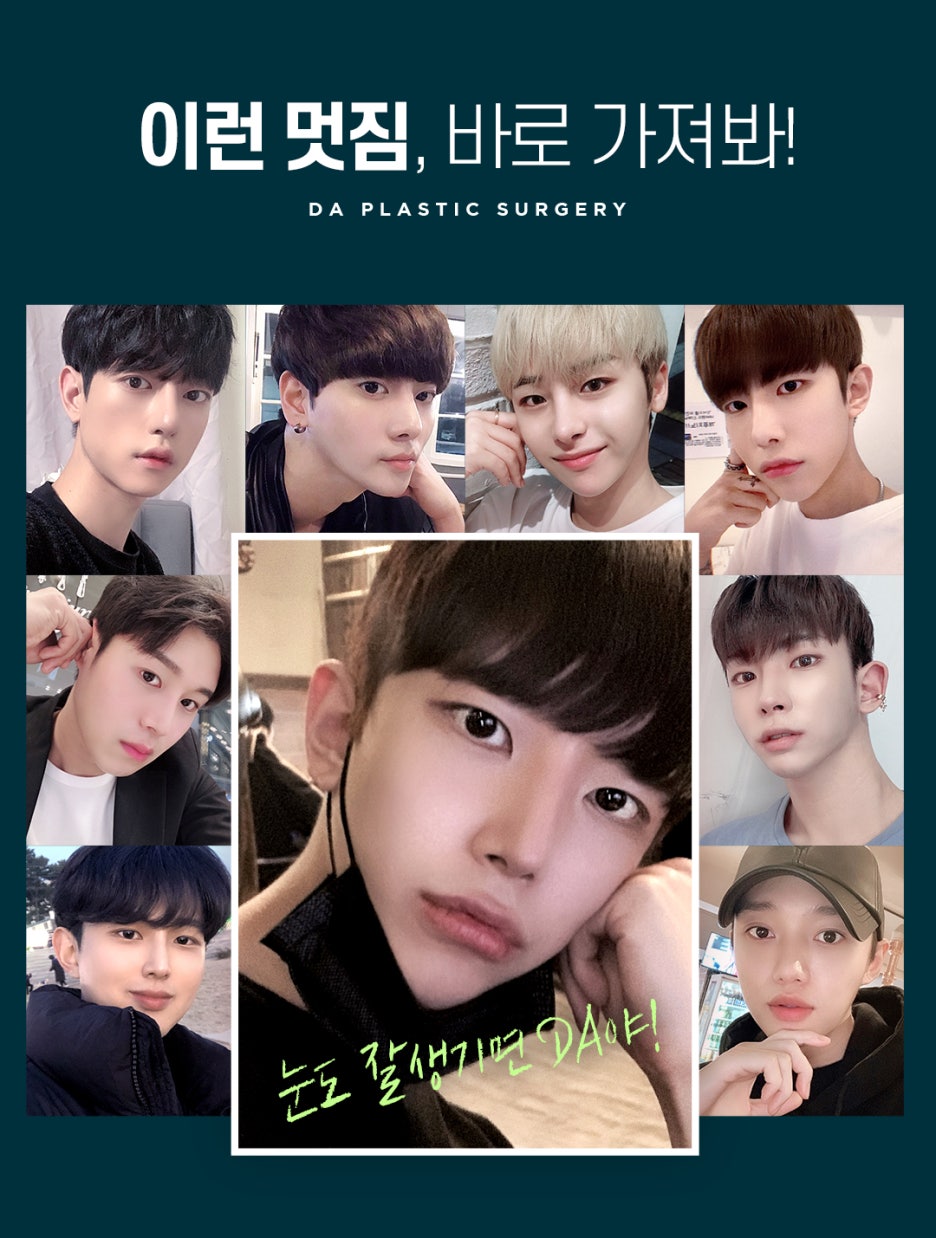 남자 몽고트임으로 자연스럽고 확실하게 관련 이미지 3