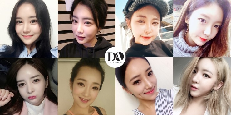 안면윤곽, 어떤 얼굴형이 큰 효과를 볼 수 있나? 관련 이미지 3