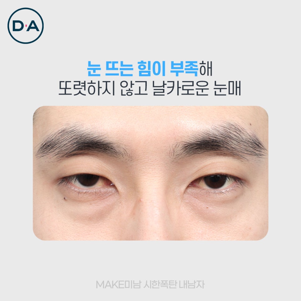 맥미남, 무엇이든물어보살 출연자는 무슨 성형 했을까? 관련 이미지 4