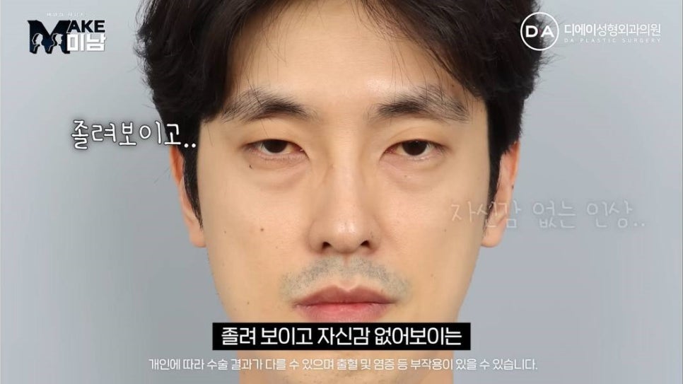 무엇이든물어보살 홍민기 성형 맥미남 후기 관련 이미지 4