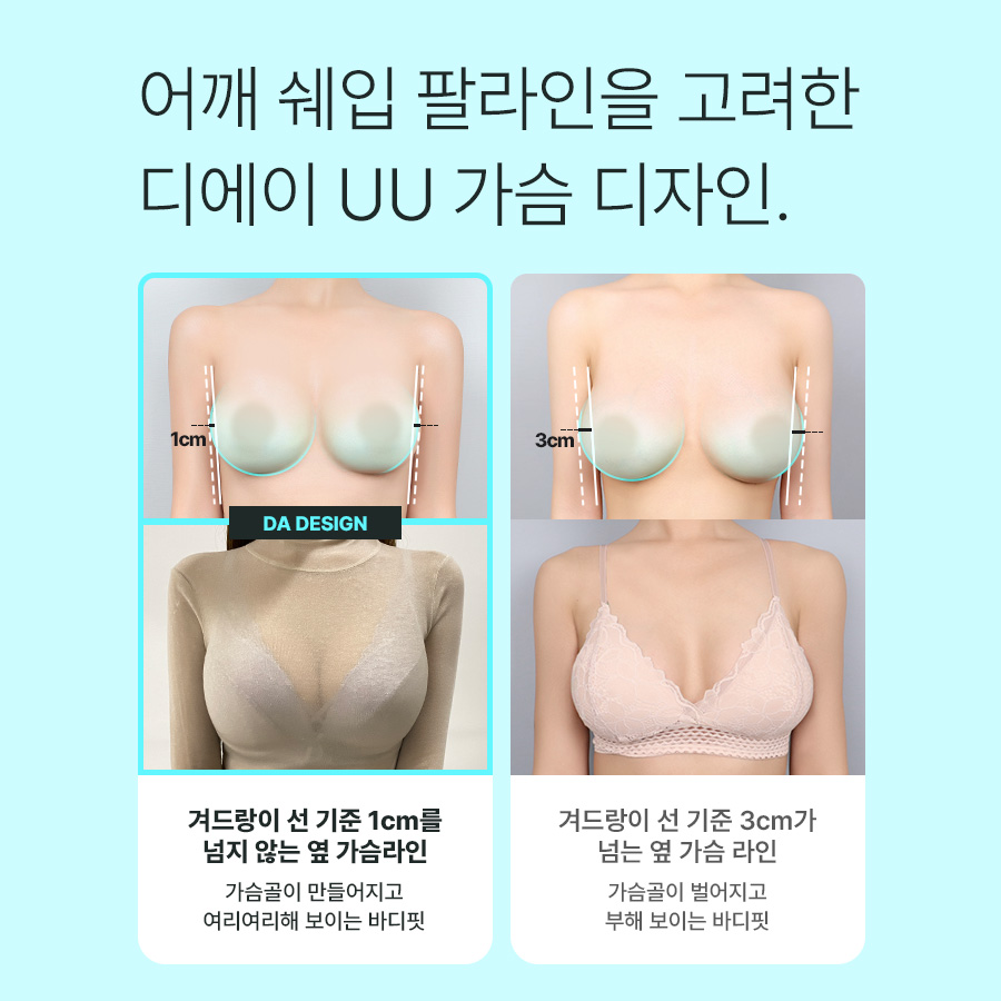 나에게 맞는 가슴성형, 체크 리스트 관련 이미지 5