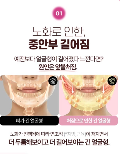 수직미니거상, 자연스러운 리프팅을 원한다면 알아볼 점 관련 이미지 2
