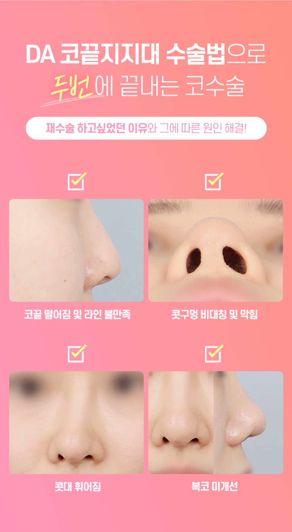 마지막 코재수술 원한다면♡ [DA성형외과] 관련 이미지 4